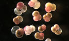 Census Marine Life: Census of Hard-to-See Marine Life : Chlamydophrys